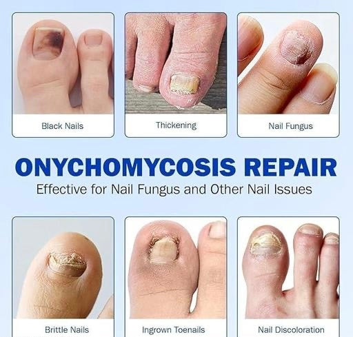 Overnight Nail Repair Patches – Easy Hydrogel Nail Care